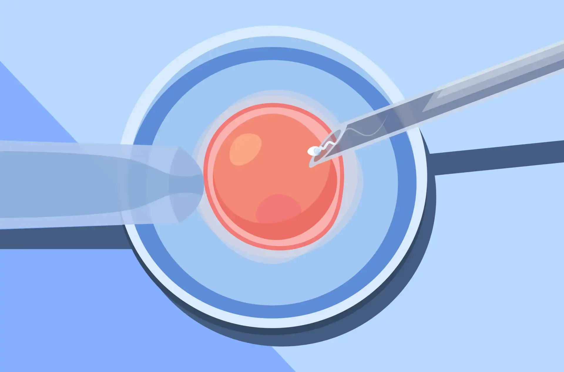 ivf cost​