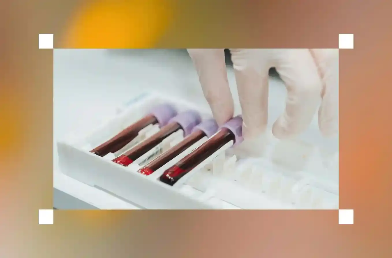 hcg blood test
