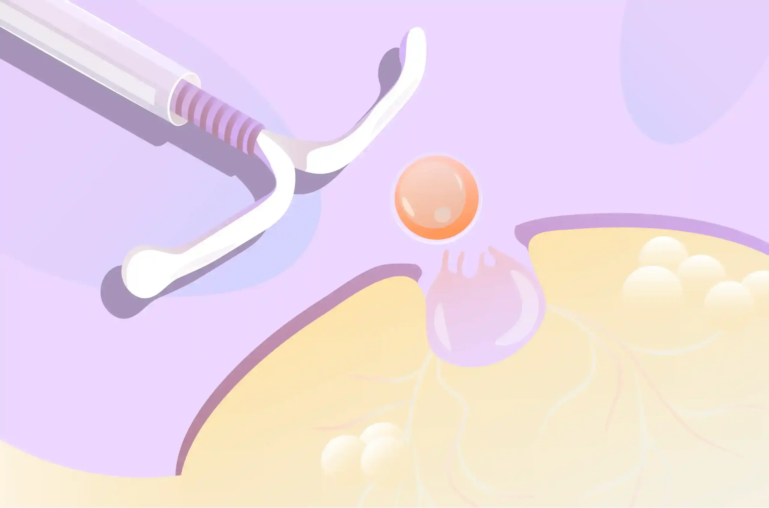 do you ovulate with an iud​