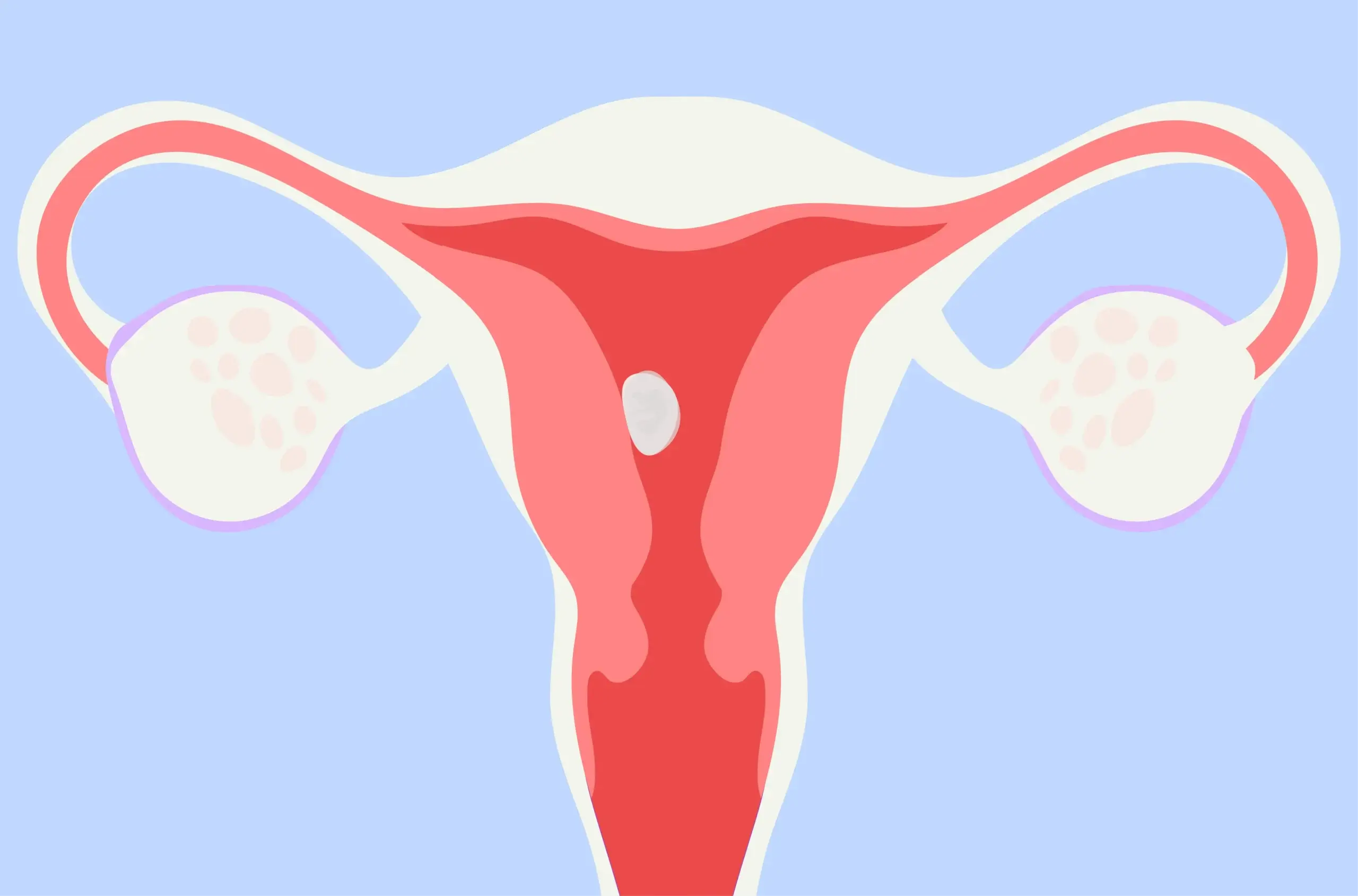 How common is a missed miscarriage