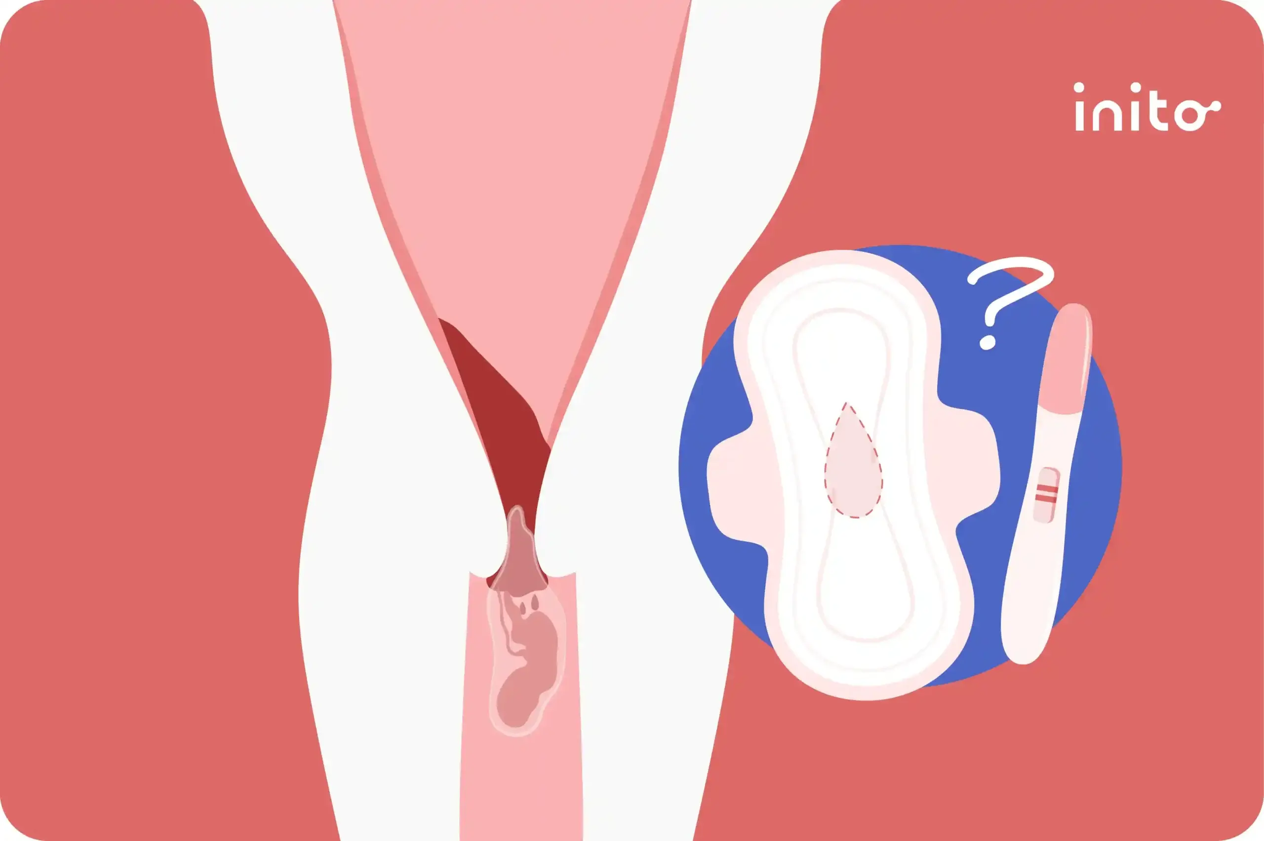 No Period After A Miscarriage, Could I Be Pregnant