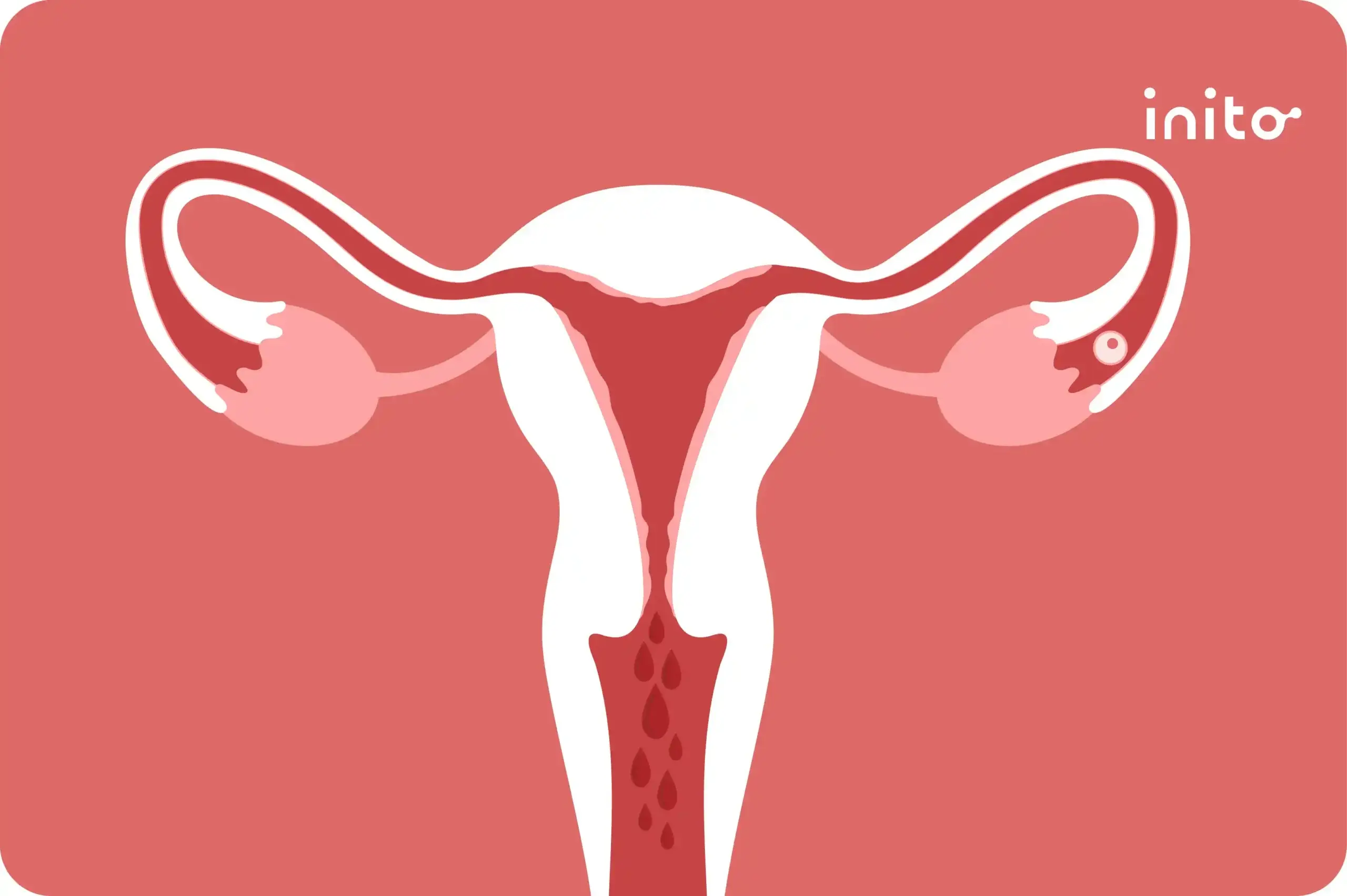 Heavy bleeding during ovulation